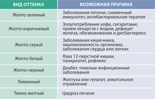 Почему язык становится желтым: причины и рекомендации